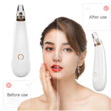 Blackhead Skin Care Dropshipping Discounted Price Face Deep Pore Acne Pimple Removal Vacuum Suction Facial Diamond Beauty Tool